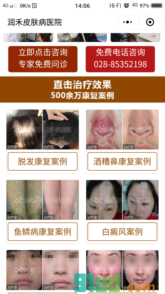 成都润禾皮肤病医院小程序截图